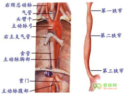 食管狭窄