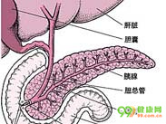 胆源性急性胰腺炎